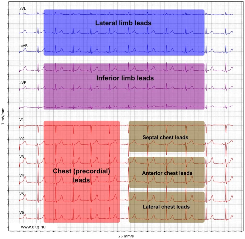 Figure 21. Presentation of the ECG leads according to the Cabrera format and aVR inverted to –aVR.
