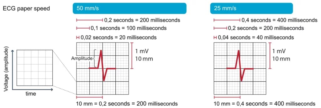 Figure 15. The ECG grid.