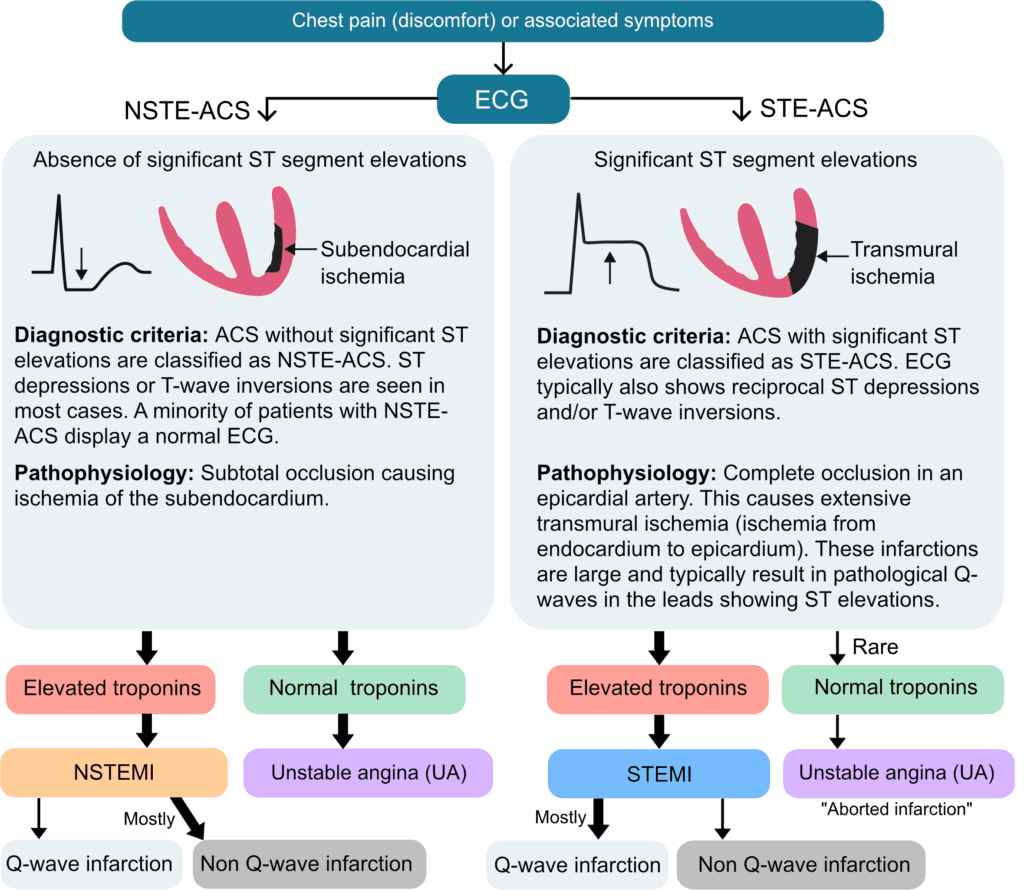 Figure 3. Traditional classification of acute coronary syndromes.