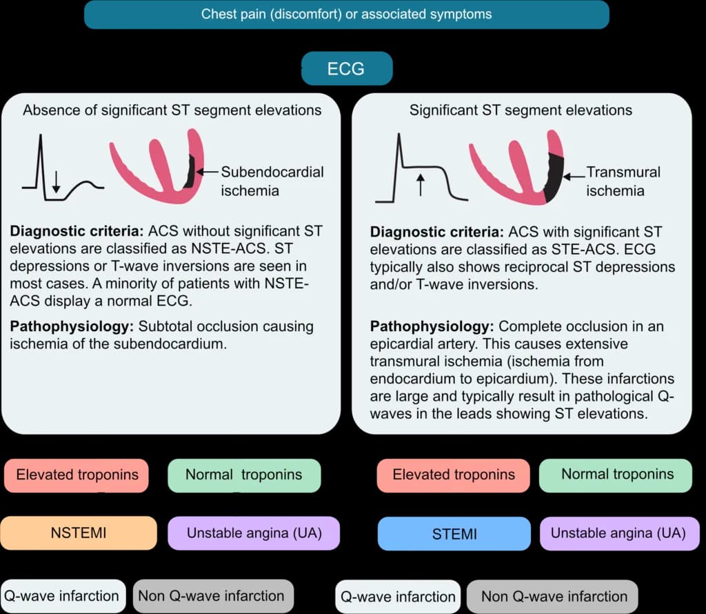 Figure 3. Traditional classification of acute coronary syndromes.