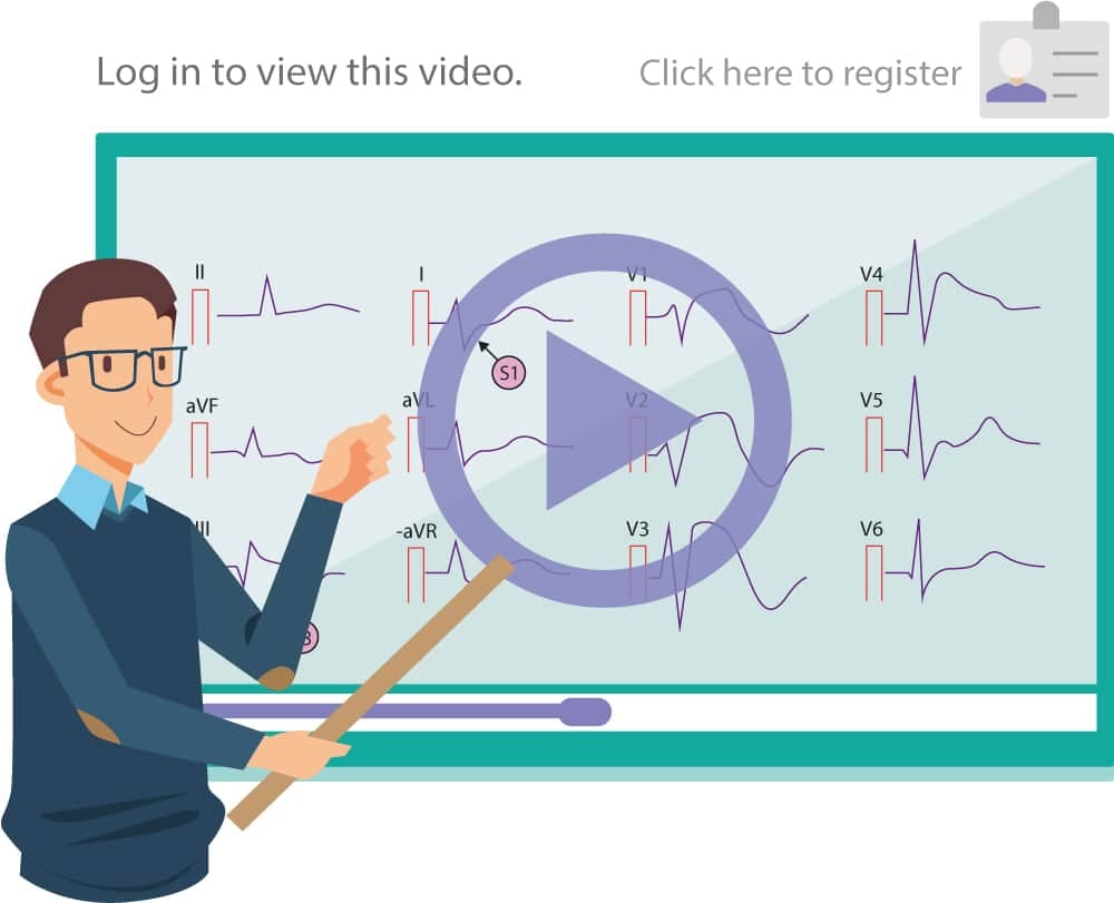Video lecture ECG interpretation and cardiac electrophysiology