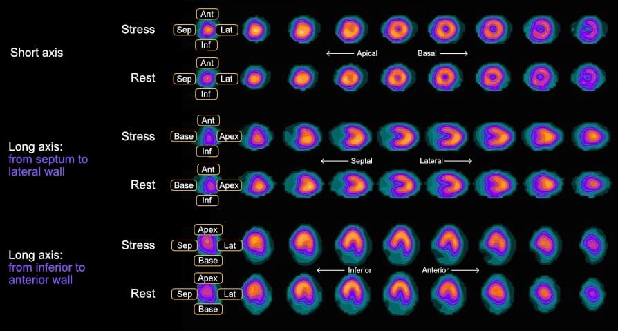 Clinical Echocardiography