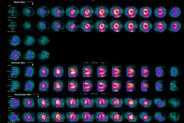 Cardiovascular Medicine