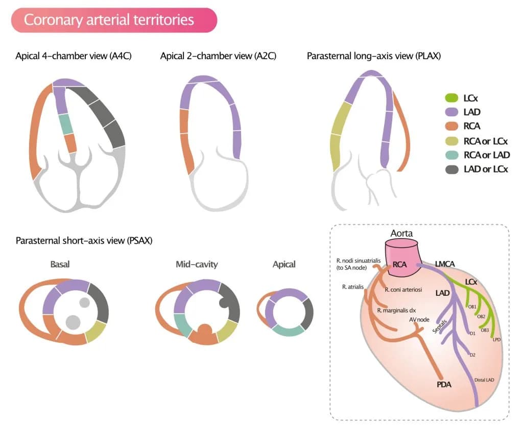 Figure 3. Assignment of the 17 myocardial segments to the territories of the left anterior descending (LAD), right coronary artery (RCA), and the left circumflex coronary artery (LCX).
