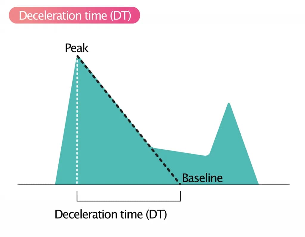 Figure 2. Deceleration time (DT).