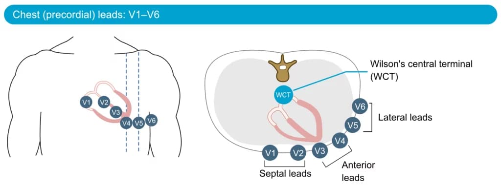 Figure 19. The chest (precordial) leads. WCT = Wilson's central terminal.