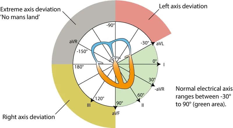 Figure 38. The electrical axis of the heart (heart axis).