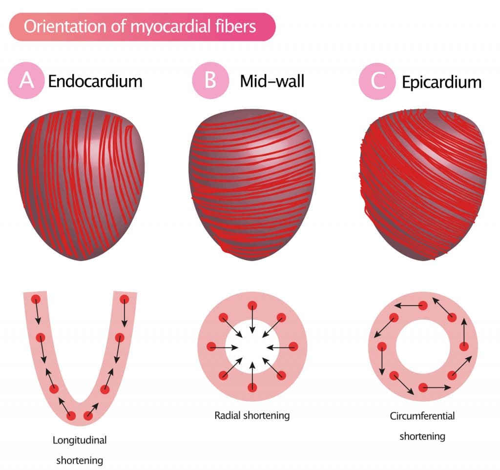 Figure 2A-2C. Orientation of myocardial muscle fibers result in longitudinal, radial and circumferential shortening (contraction).