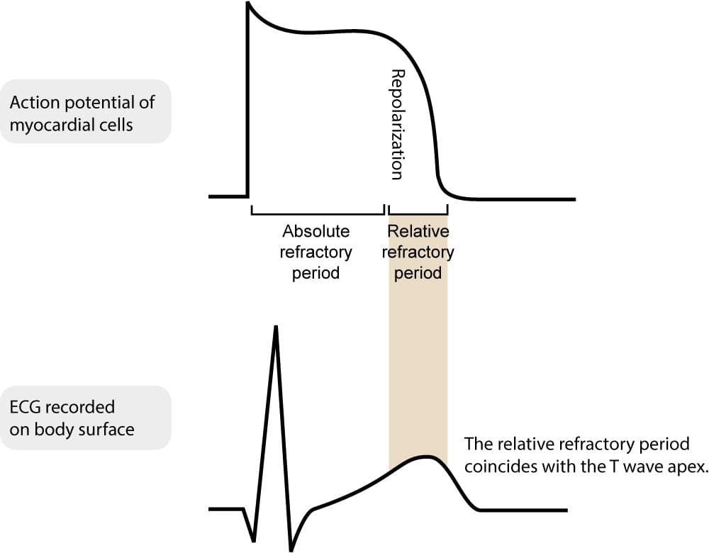 Figure 5. Absolute and relative refractory period.