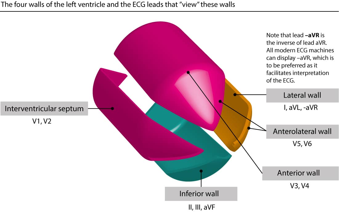 The 12-lead ECG records information on electrical activity of the left ventricle. As seen here, the left ventricle takes the shape of a bullet. It can be divided into four walls, and this figure displays which leads that best record electrical activity of each wall.