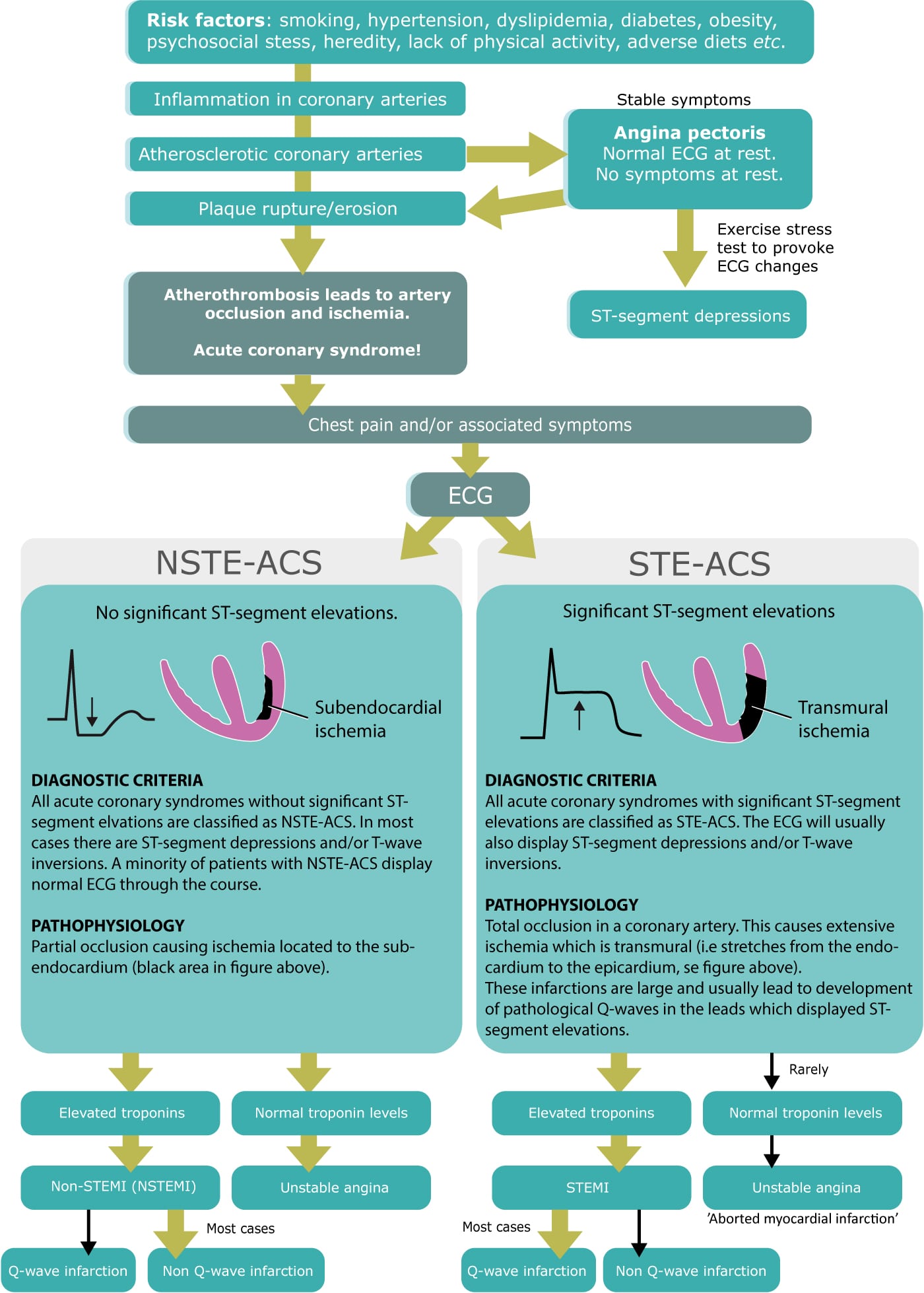 Figure 2. Classification of acute coronary syndromes into STE-ACS (STEMI, ST elevation myocardial infarction) and NSTE-ACS (Non STEMI and unstable angina [UA]).