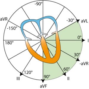 Figure 2. The coordinate system presenting the limb leads in the frontal plane.