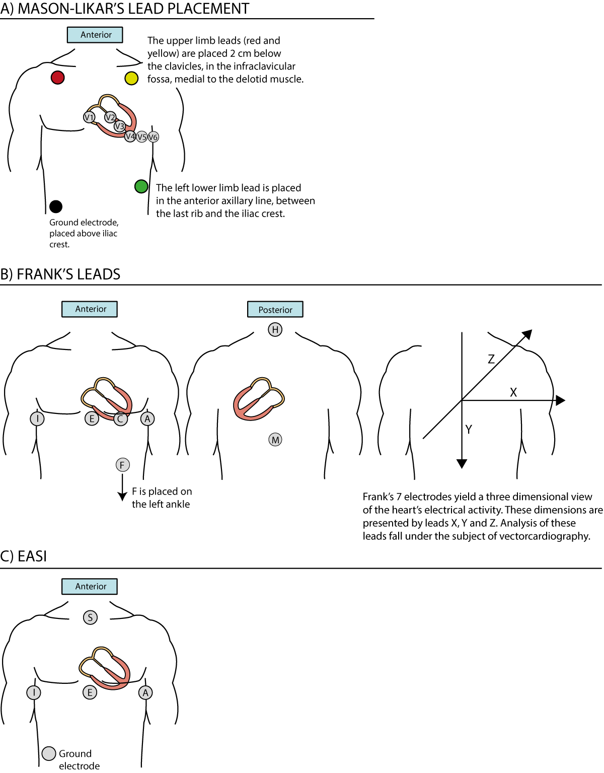 Figure 24. Alternative ECG lead systems.
