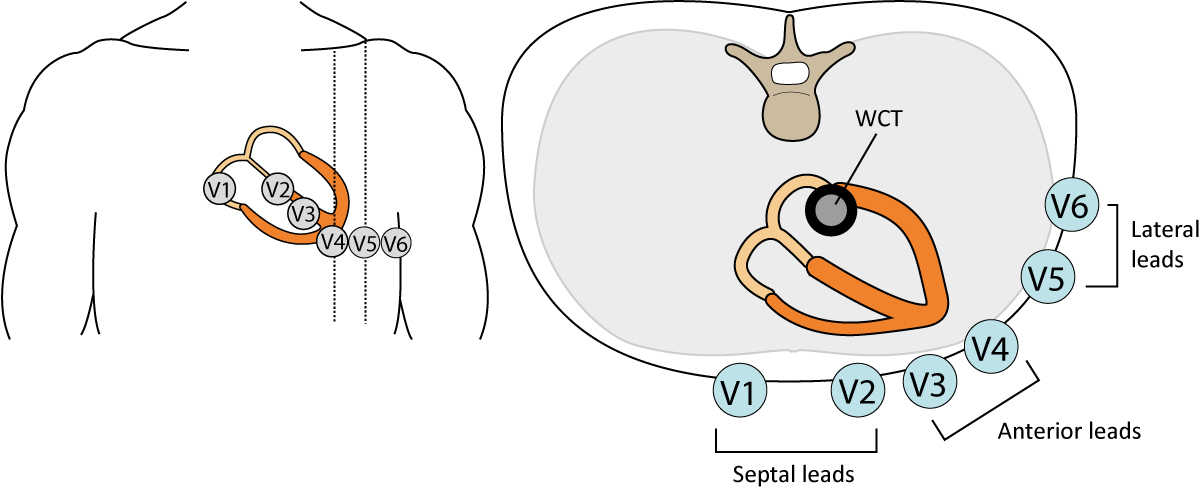 Figur 19. The chest (precordial) leads. WCT = Wilson's central terminal.