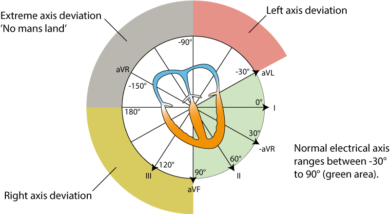 Figure 38. The electrical axis of the heart (heart axis).