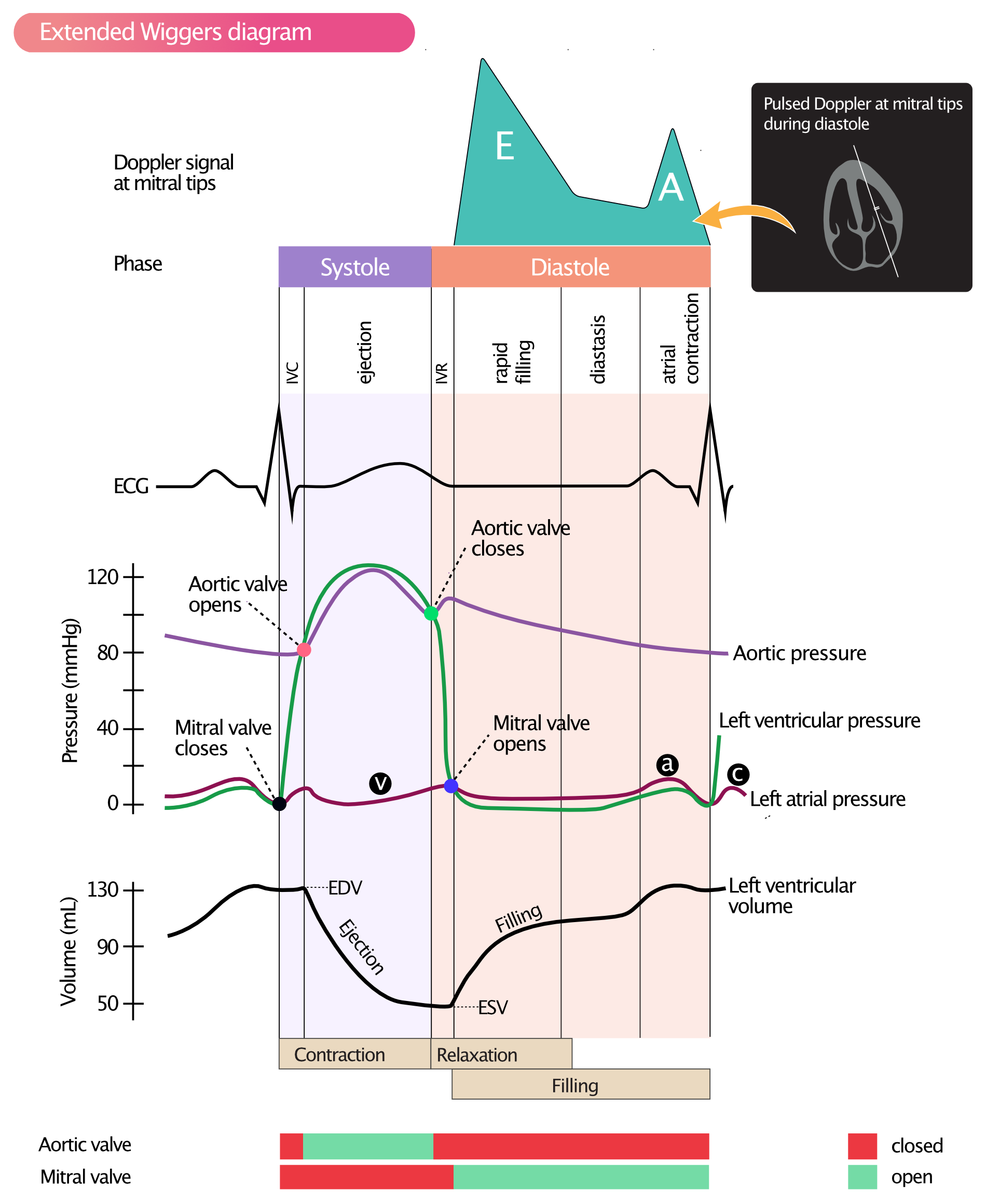 Figure 2. Wiggers diagram showing pressure, volume, Doppler signal, ECG and AV valves during the cardiac cycle. Doppler recording of mitral valve flow during diastole. (a) = active atrial filling; (b) = increased atrial pressure due to bulging of mitral valve into the left atrium, when valve closes; (c) = passive atrial filling.