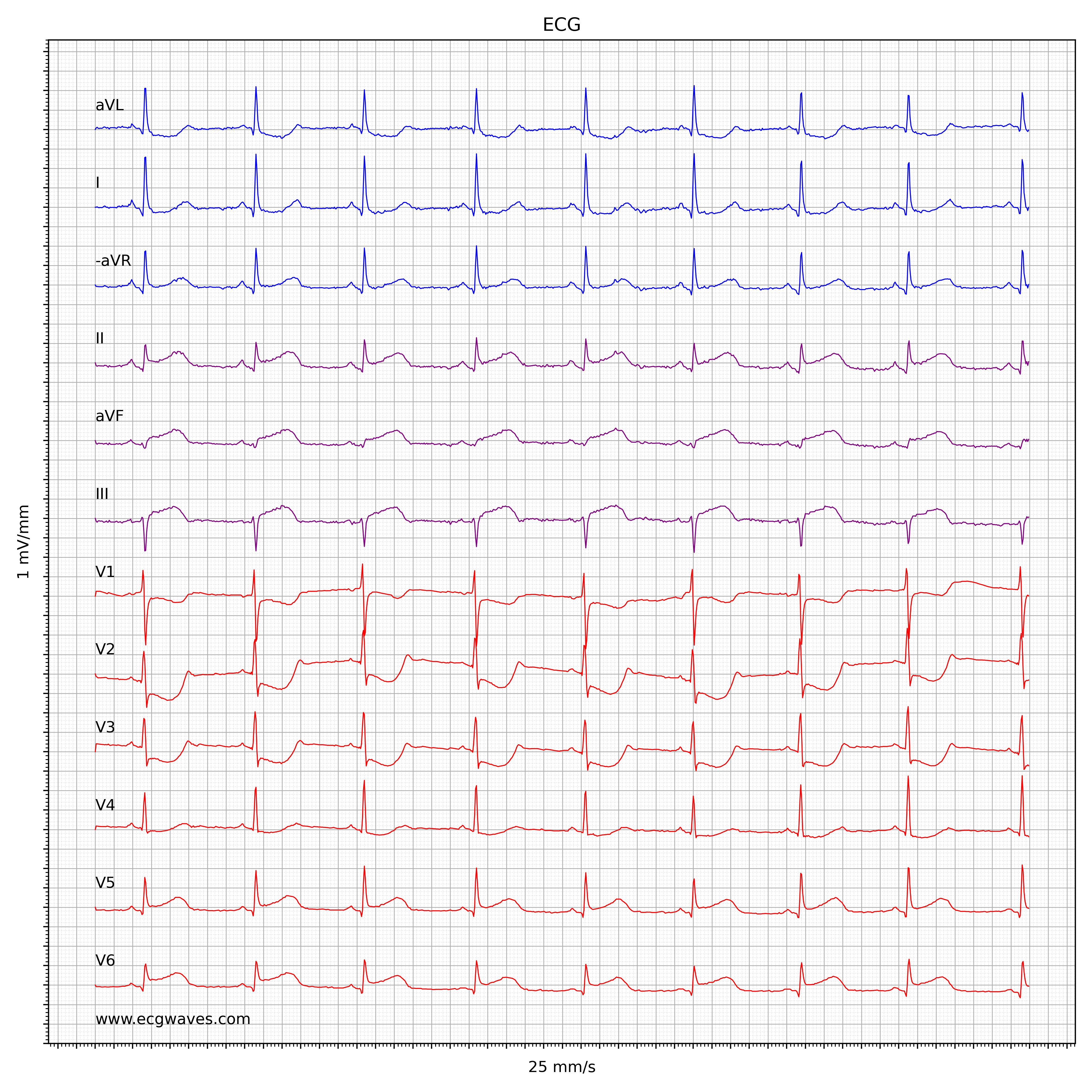 ECG Test 3 - Question 1