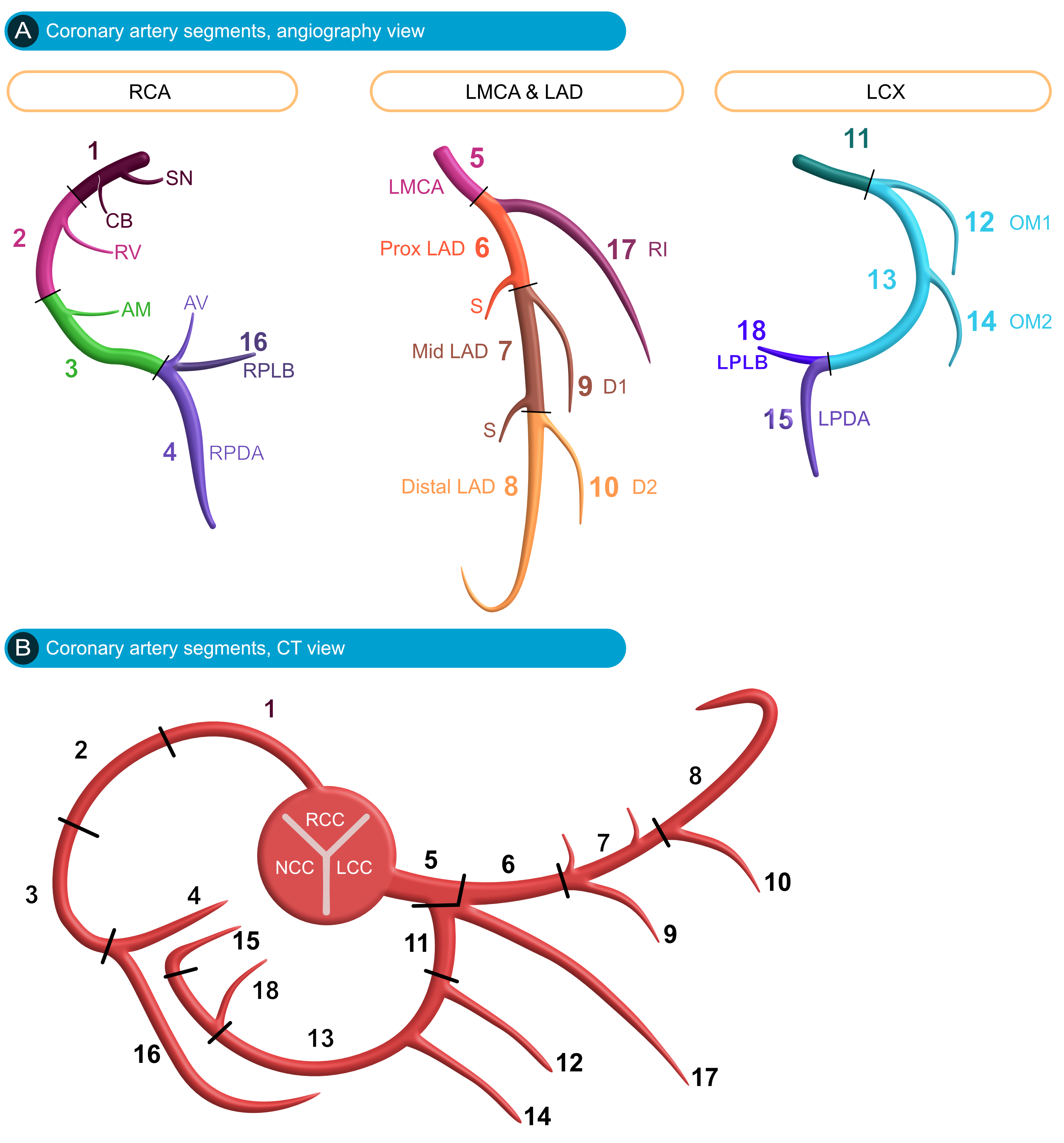 Figure 1A. Detailed diagram of coronary artery segments. CT = computerized tomography.